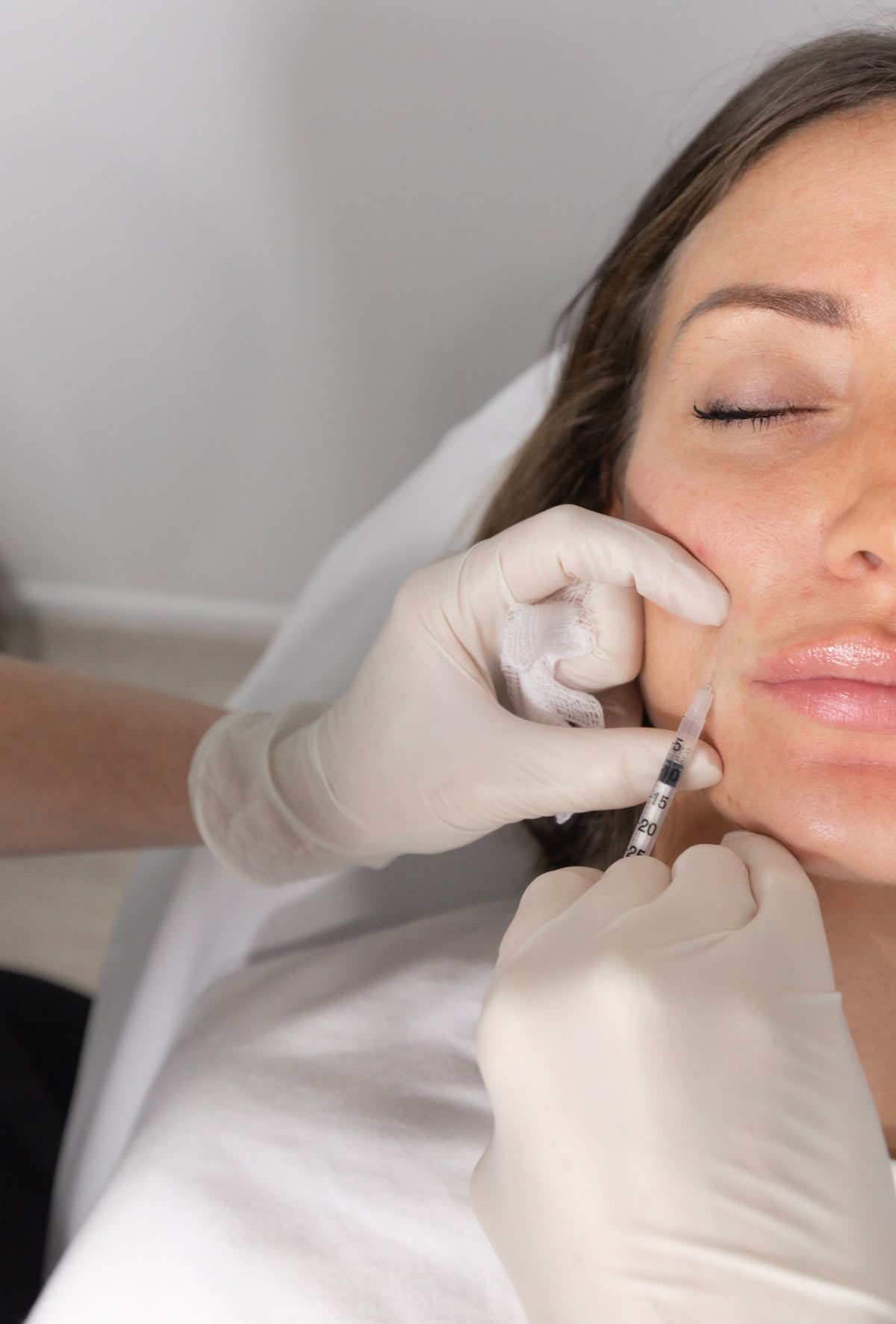 Dermal filler injection by a medical professional at EliteMD Aesthetics in Markham