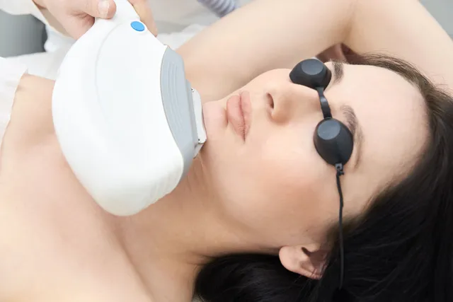 Exci308 excimer light therapy at EliteMD Aesthetics in Markham