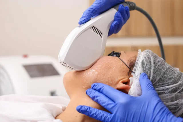 Targeted excimer light therapy at EliteMD