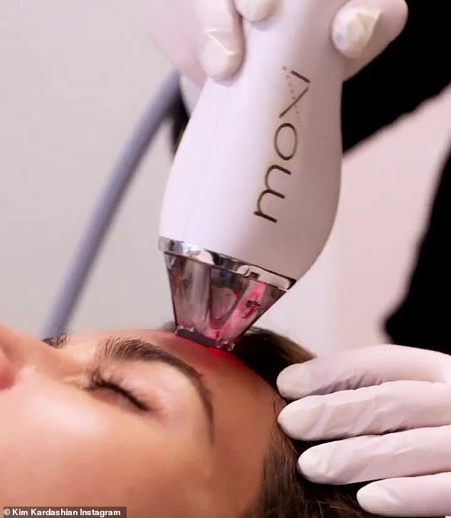 Moxi gentle fractionated laser treatment at EliteMD Aesthetics in Markham