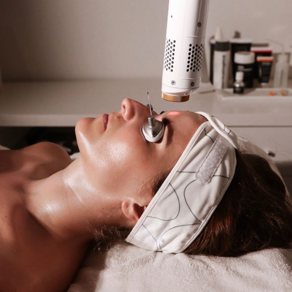 Aerolase NeoElite 650-microsecond laser platform at EliteMD Aesthetics in Markham