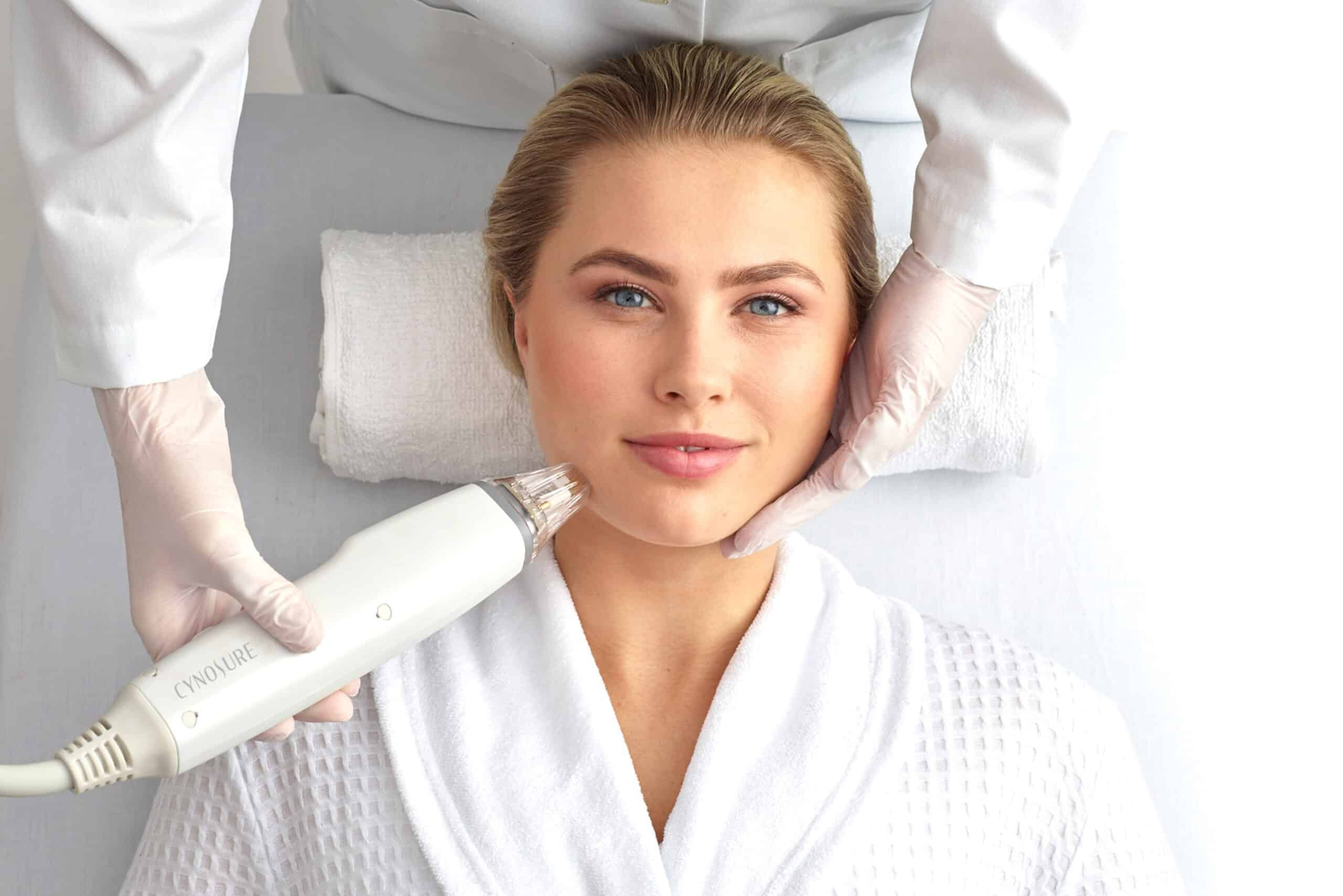 Cynosure Potenza RF microneedling treatment at EliteMD Aesthetics in Markham